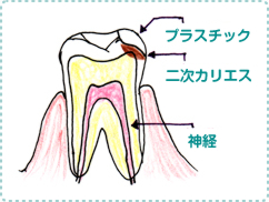 歯の画像