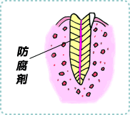 歯髄炎の治療4