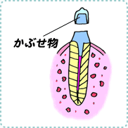 歯髄炎の治療6